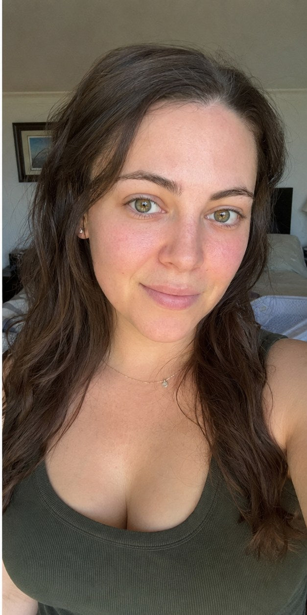 After HER VENUS